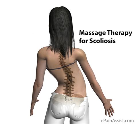 Massage Therapy For Scoliosis Techniques And Prevention