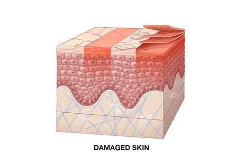repair  damaged skin barrier function kiehls uk
