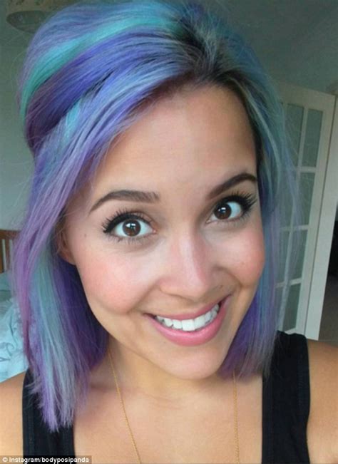 Instagrammer Megan Crabbe Who Was Ashamed Of Her Face