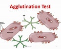 Image result for Agglutination. Size: 125 x 100. Source: microbenotes.com