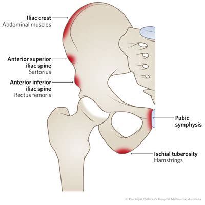 anterior superior iliac spine muscle attachment