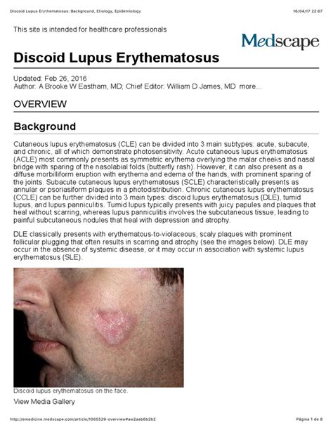 Discoid Lupus Treatment Face Doctor Heck