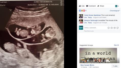 mom of 3 shocked to learn she s expecting sextuplets fox news