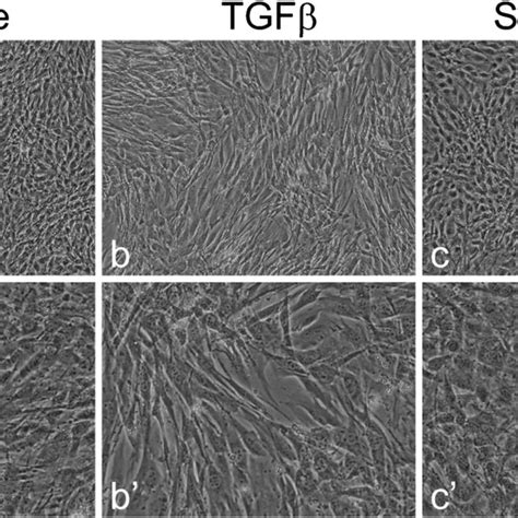 Tgfβ Induces Cellular Elongation In Ttt Gf Cells Ttt Gf Cells Were