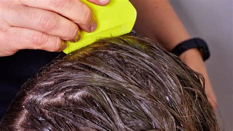 hair dye kill lice   eggs complete guide