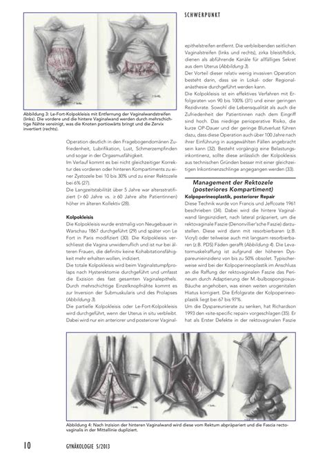 deszensuschirurgie rosenfluh ch