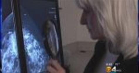 Diagnosing Breast Cancer At Its Earliest Stages Cw Tampa