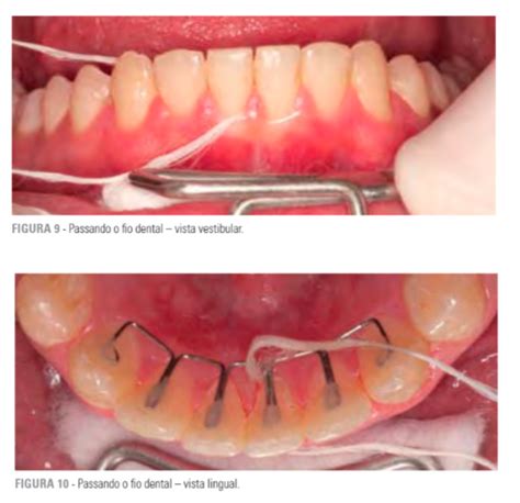 artigos sobre ortodontia e ortopedia facial cesar bigarella