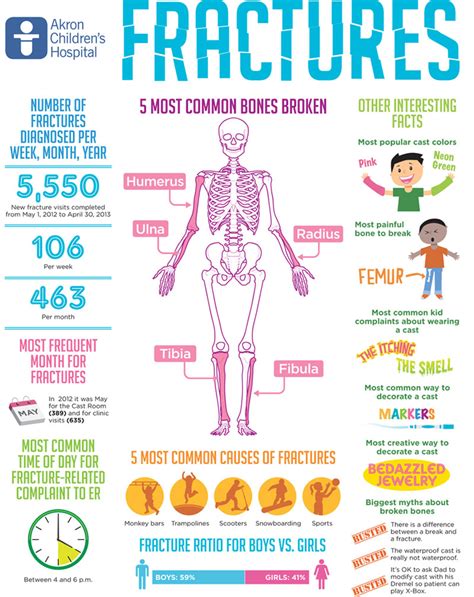 infographic colorful casts abound  fracture seasoninside childrens blog