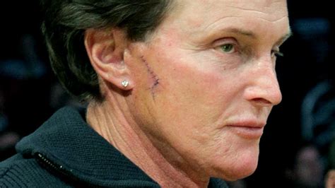 an open letter to bruce jenner vice