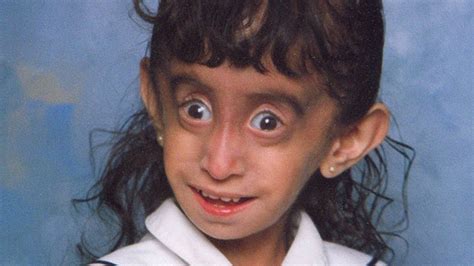 They Called Her ‘the World’s Ugliest Girl’ Here’s What Happened To Her