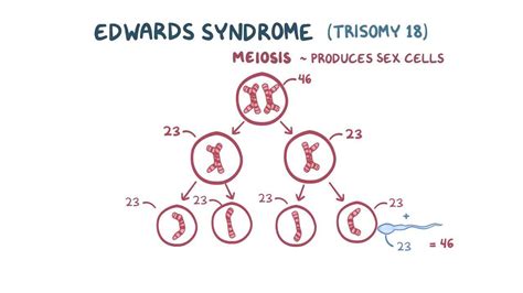 Turner Syndrome Meiotic Nondisjunction Captions More