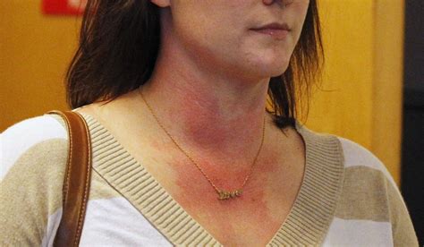 illinois woman who faked cancer gets 3 year sentence washington times