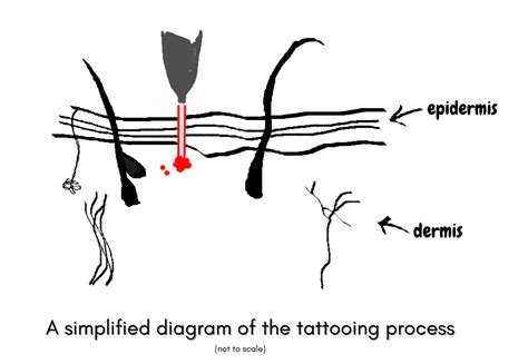 tattoo tattoos remove