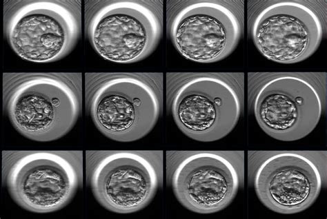 artificial intelligence approach optimizes embryo selection  ivf