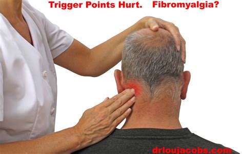 muscle rocks trigger point therapy jacobs chiropractic acupuncture