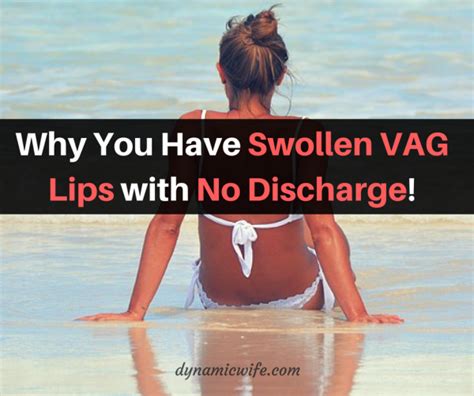 why you have itchy swollen vaginal lips with no discharge