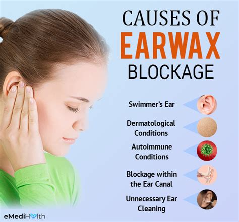 earwax buildup ways  remove