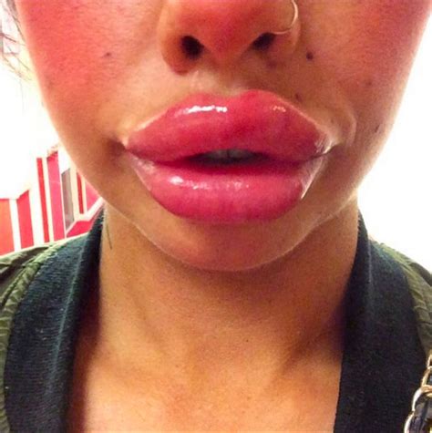 squiggly lips are the latest fad here s what you hope you didn t know