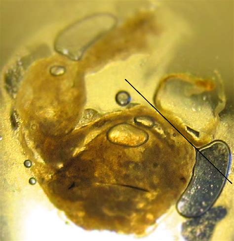 please help me identify possible nasal worm w pics at parasites support forum alt med with
