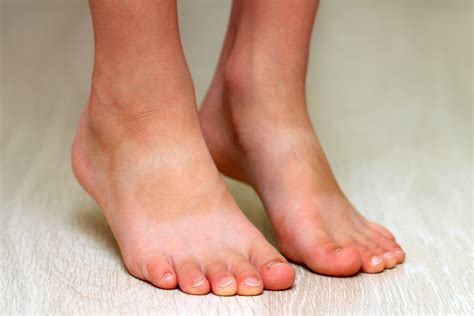 flat feet  children         avoided   mom