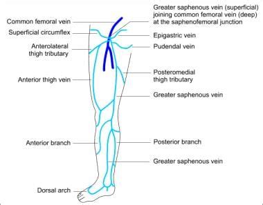varicose vein surgery background anatomy pathophysiology