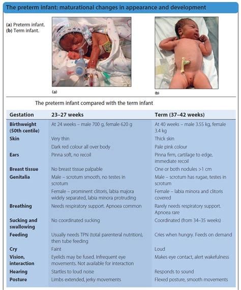 preterm infant compared   term infant preterm grepmed