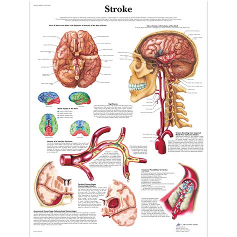 anatomical charts neurological posters pathology posters