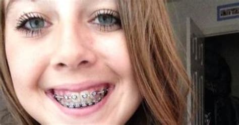 What Do You Think Of Girls With Braces Girlsaskguys