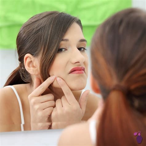 8 ways to fight pesky pimples eau talk the official fragrancenet