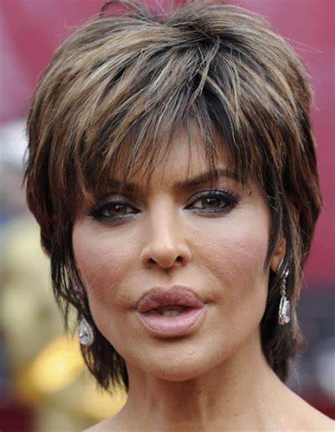 lisa rinna lips before and after