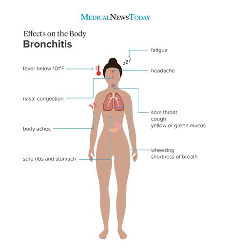 what are the symptoms of bronchitis