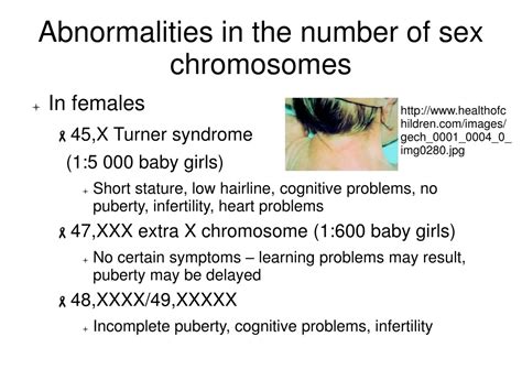 Ppt Chromosome Disorders – Numerical Abnormalities Powerpoint