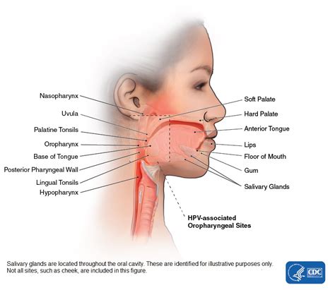 what does throat cancer look like images throat cancer high