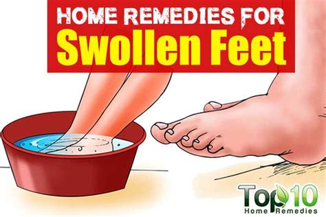 home remedies for swollen feet top 10 home remedies swollen feet