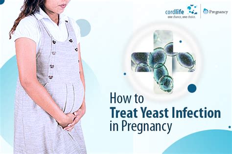 how to treat yeast infection in pregnancy cordlife india