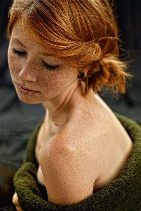 Covered Freckles Redhead Red Hair Freckles Redheads Freckles