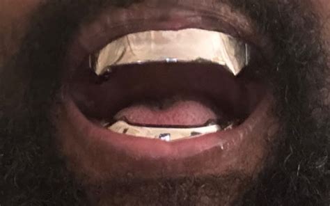 kanye west shows   jaws inspired teeth