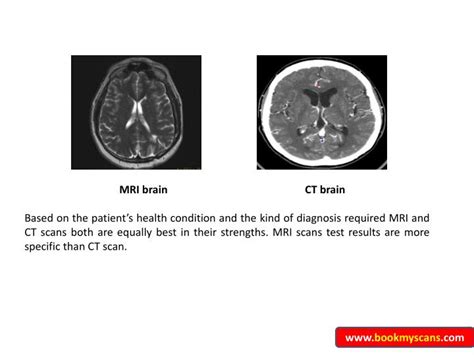 Ppt Mri Vs Ct Scans In Bangalore Bookmyscans