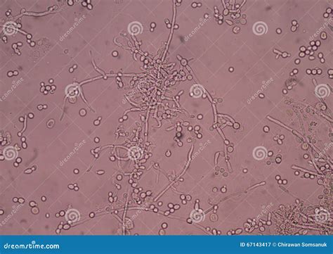 budding yeast cells  pseudohyphae  urine sample stock image image  microscope
