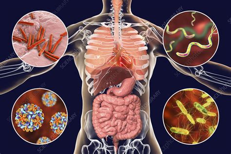 Bacteria That Cause Human Infections Illustration Stock Image F023