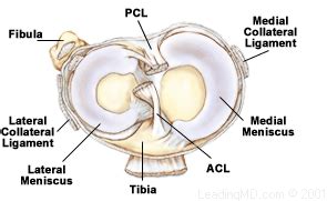 lateral meniscus physiopedia