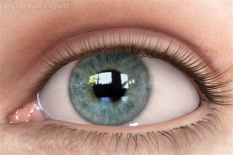 contacts    kadrmas eye care  england