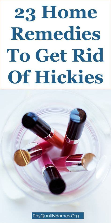 how to get rid of hickies hickeys fast 23 home remedies get rid of hickies how to hide