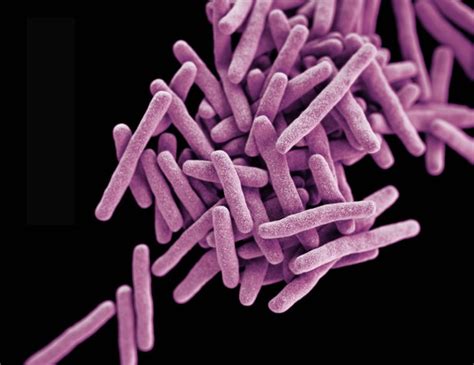 tuberculosis bacteria thrive   nitrogen source buffet elife