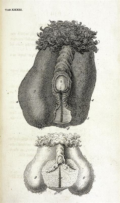 hermaphrodite sex organs photograph by british library