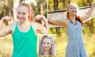 madeline stuart with down syndrome lands contract with