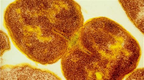 Untreatable Super Gonorrhea Spreading Orally Who Warns Wjax Tv