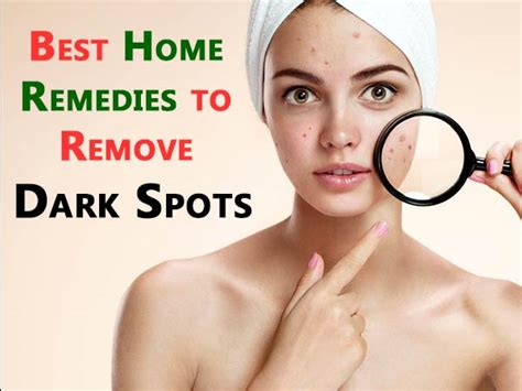 best home remedies to remove dark spots