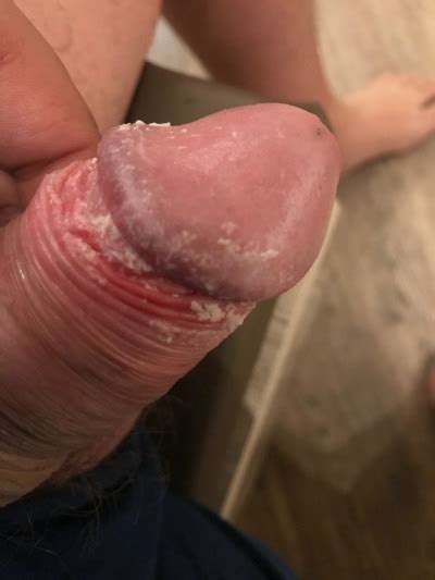 mmm nice cheesy cock thanks for the submission tumbex